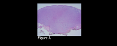 Figure A