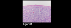 Figure B