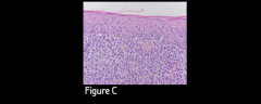 Figure C