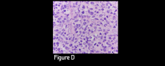 Figure D