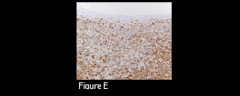 Figure E